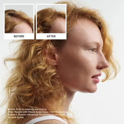 Nioxin System 1 Loyalty Kit - Scalp & Hair Thickening for Natural Hair with Light Thinning