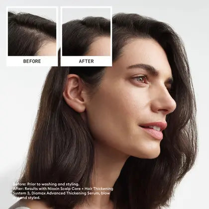 Nioxin System 3 Loyalty Kit -  Scalp & Hair Thickening for Coloured, Dry and Damaged Hair Treated Hair with Light Thinning